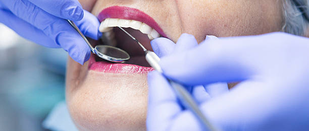 Best Knocked-Out Tooth (Avulsed Tooth) Treatment in Cle Elum, WA